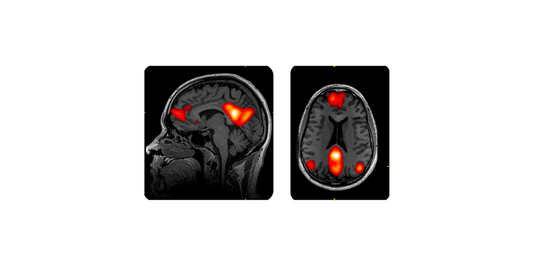 Why Meditate from The Science of Objects?